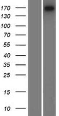 Western Blot: LAMC3 Overexpression Lysate [NBP2-07673]