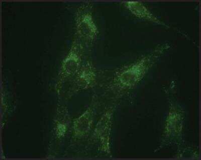 Immunocytochemistry/ Immunofluorescence: LAMP-1/CD107a Antibody - BSA Free [NB600-956]