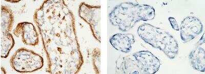 Immunohistochemistry-Paraffin: LAMP-1/CD107a Antibody (107) [NBP2-89844]