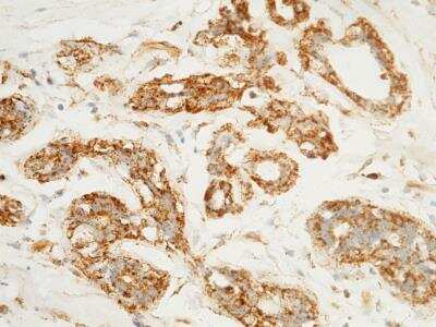 Immunohistochemistry-Paraffin: LAMP-1/CD107a Antibody (107) [NBP2-89844]