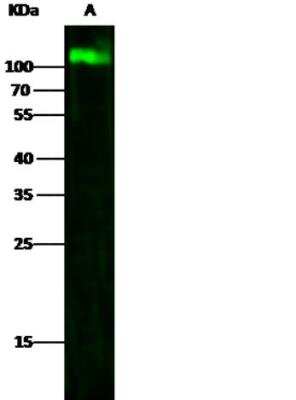 Western Blot: LAMP-1/CD107a Antibody (107) [NBP2-89844]