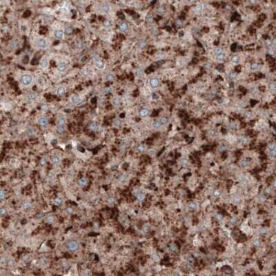 Immunohistochemistry-Paraffin: LAMP-1/CD107a Antibody (CL3484) [NBP2-59780]