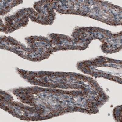 Immunohistochemistry-Paraffin: LAMP-1/CD107a Antibody (CL3484) [NBP2-59780]