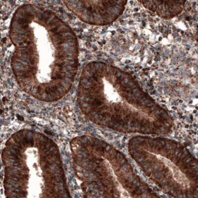 Immunohistochemistry-Paraffin: LAMP-1/CD107a Antibody (CL3484) [NBP2-59780]