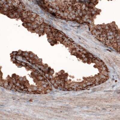 Immunohistochemistry-Paraffin: LAMP-1/CD107a Antibody (CL3484) [NBP2-59780]