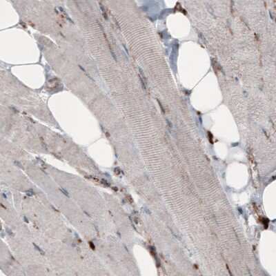 Immunohistochemistry-Paraffin: LAMP-1/CD107a Antibody (CL3484) [NBP2-59780]
