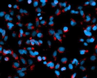 Immunocytochemistry/ Immunofluorescence: LAMP-1/CD107a Antibody (5E7) - Azide and BSA Free [NBP2-80824]