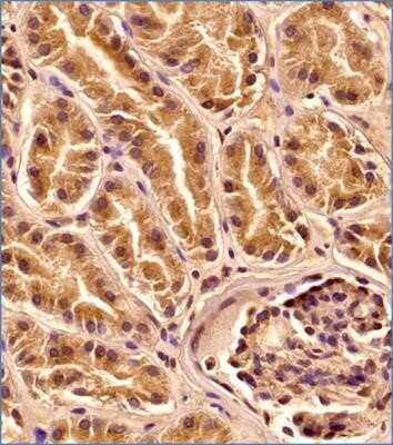 Immunohistochemistry-Paraffin: LAMP-1/CD107a Antibody (5E7) - Azide and BSA Free [NBP2-80824]