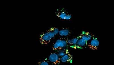 Immunocytochemistry/ Immunofluorescence: LAMP-1/CD107a Antibody (5E7) - BSA Free [NBP2-52721]