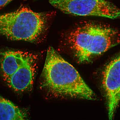 Immunocytochemistry/ Immunofluorescence: LAMP-1/CD107a Antibody (5H6) [NBP2-25154]