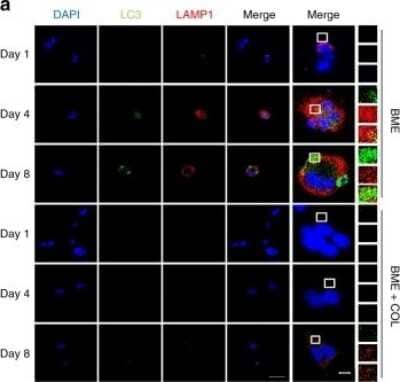Immunocytochemistry/ Immunofluorescence: LAMP-1/CD107a Antibody (5H6) [NBP2-25154]
