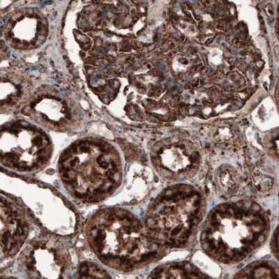 Immunohistochemistry-Paraffin: LAMP-1/CD107a Antibody (CL3482) [NBP2-61619]