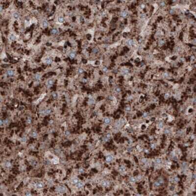 Immunohistochemistry-Paraffin: LAMP-1/CD107a Antibody (CL3482) [NBP2-61619]