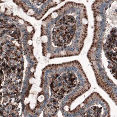 Immunohistochemistry-Paraffin: LAMP-1/CD107a Antibody (CL3482) [NBP2-61619]