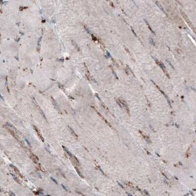 Immunohistochemistry-Paraffin: LAMP-1/CD107a Antibody (CL3482) [NBP2-61619]