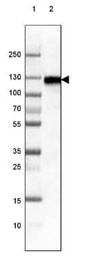 Western Blot: LAMP-1/CD107a Antibody (CL3482) [NBP2-61619]