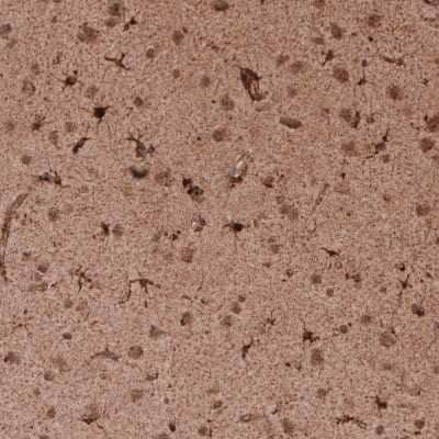 Immunohistochemistry-Paraffin: LAMP-1/CD107a Antibody (CL4463) [NBP2-59051]