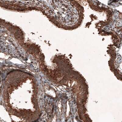 Immunohistochemistry-Paraffin: LAMP-1/CD107a Antibody (CL4463) [NBP2-59051]
