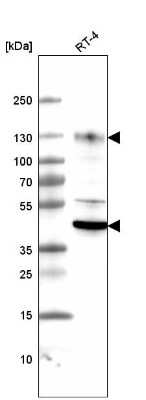 Western Blot: LAMP-1/CD107a Antibody (CL4463) [NBP2-59051]