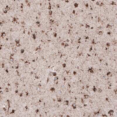 Immunohistochemistry-Paraffin: LAMP-1/CD107a Antibody (CL4472) [NBP2-59052]