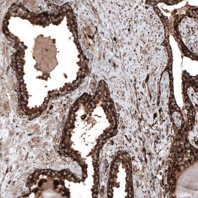 Immunohistochemistry-Paraffin: LAMP-1/CD107a Antibody (CL4472) [NBP2-59052]