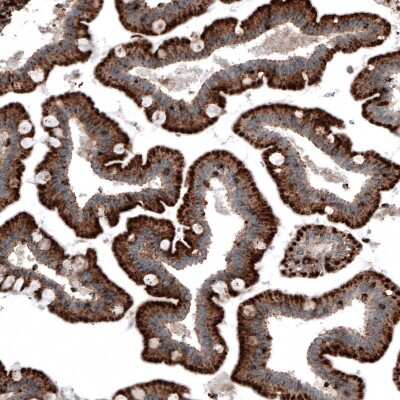 Immunohistochemistry-Paraffin: LAMP-1/CD107a Antibody (CL4472) [NBP2-59052]