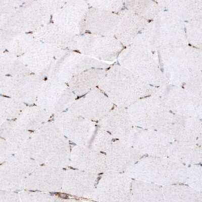 Immunohistochemistry-Paraffin: LAMP-1/CD107a Antibody (CL4472) [NBP2-59052]