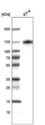 Western Blot: LAMP-1/CD107a Antibody (CL4472) [NBP2-59052]