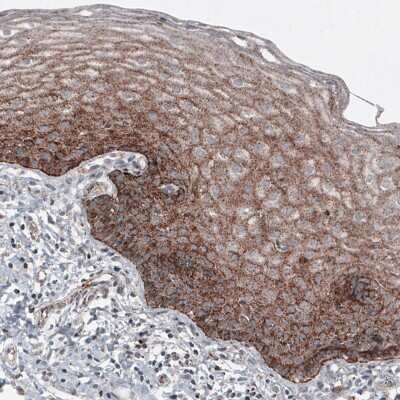 Immunohistochemistry-Paraffin: LAMP-1/CD107a Antibody (CL4489) [NBP2-59053]