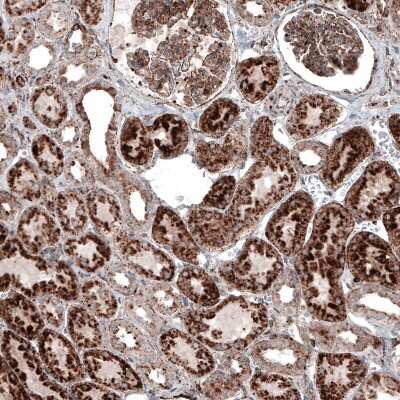 Immunohistochemistry-Paraffin: LAMP-1/CD107a Antibody (CL4489) [NBP2-59053]