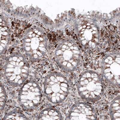 Immunohistochemistry-Paraffin: LAMP-1/CD107a Antibody (CL4489) [NBP2-59053]