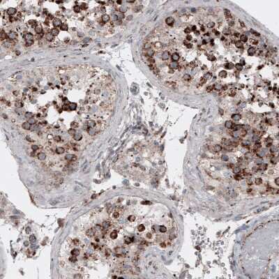 Immunohistochemistry-Paraffin: LAMP-1/CD107a Antibody (CL4489) [NBP2-59053]