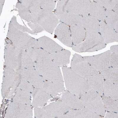 Immunohistochemistry-Paraffin: LAMP-1/CD107a Antibody (CL4489) [NBP2-59053]