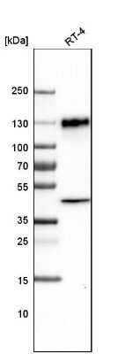 Western Blot: LAMP-1/CD107a Antibody (CL4489) [NBP2-59053]