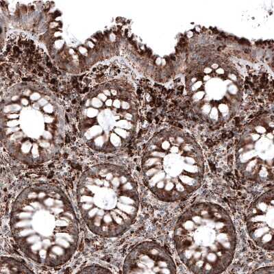 Immunohistochemistry-Paraffin: LAMP-1/CD107a Antibody (CL4490) [NBP2-59054]