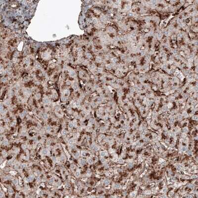 Immunohistochemistry-Paraffin: LAMP-1/CD107a Antibody (CL4490) [NBP2-59054]