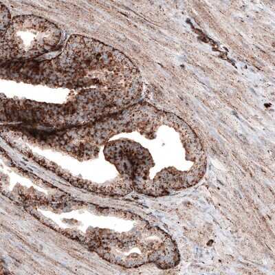 Immunohistochemistry-Paraffin: LAMP-1/CD107a Antibody (CL4490) [NBP2-59054]