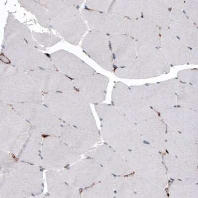 Immunohistochemistry-Paraffin: LAMP-1/CD107a Antibody (CL4490) [NBP2-59054]