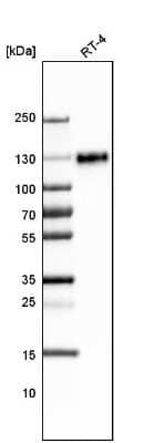 Western Blot: LAMP-1/CD107a Antibody (CL4490) [NBP2-59054]