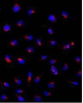 Immunocytochemistry/ Immunofluorescence: LAMP-1/CD107a Antibody (H4A3) - Azide and BSA Free [NBP2-25183]