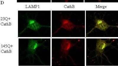 Immunocytochemistry/ Immunofluorescence: LAMP-1/CD107a Antibody [NB120-19294]