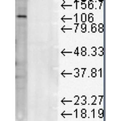 Western Blot: LAMP-1/CD107a Antibody (LY1C6) [NB100-1952]