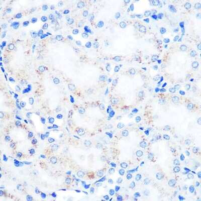 Immunohistochemistry-Paraffin: LAMP-2/CD107b Antibody (5N8J3) [NBP3-15282]