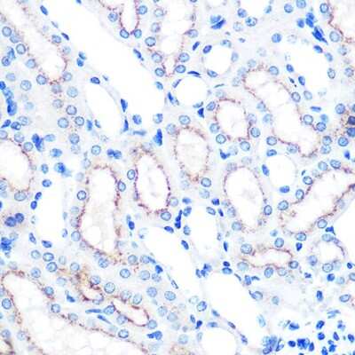 Immunohistochemistry-Paraffin: LAMP-2/CD107b Antibody (5N8J3) [NBP3-15282]