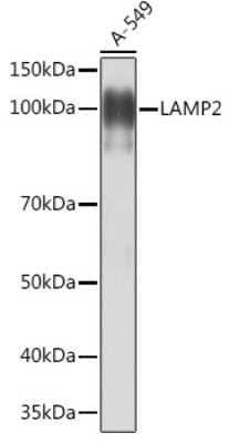 Western Blot: LAMP-2/CD107b Antibody (5N8J3) [NBP3-15282]