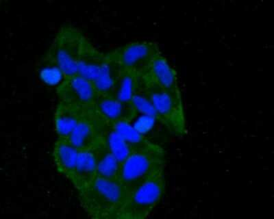Immunocytochemistry/ Immunofluorescence: LAMP-2/CD107b Antibody (C9-9) [NBP2-66929]