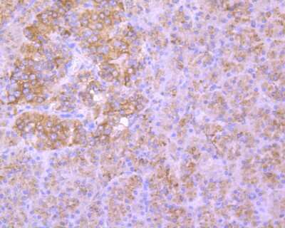 Immunohistochemistry-Paraffin: LAMP-2/CD107b Antibody (C9-9) [NBP2-66929]