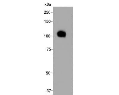 Western Blot: LAMP-2/CD107b Antibody (C9-9) [NBP2-66929]