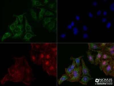 Immunocytochemistry/ Immunofluorescence: LAMP-2/CD107b Antibody (H4B4) - Azide and BSA Free [NBP2-80825]
