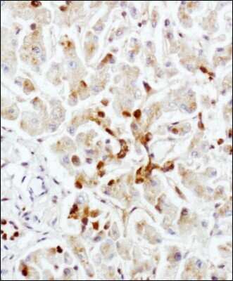Immunohistochemistry: LAMP-2/CD107b Antibody (H4B4) - Azide and BSA Free [NBP2-80825]